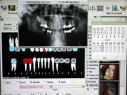 fogászati fotók, röntgen, kezelési terv, 