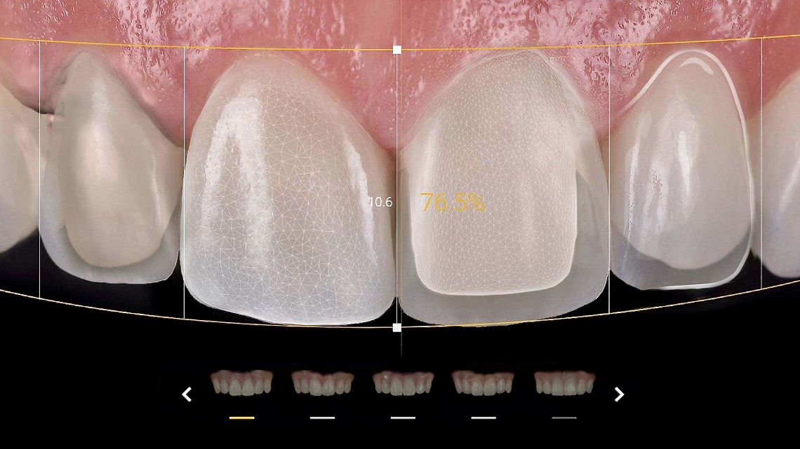 torokugrato-dental-esztetikai-fogaszat